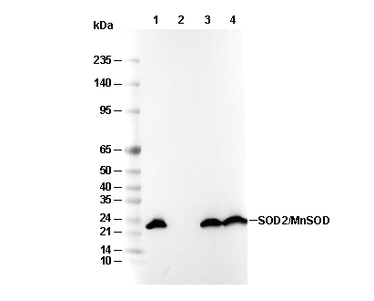 SOD2/MnSOD Antibody