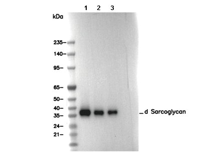 δ Sarcoglycan Antibody