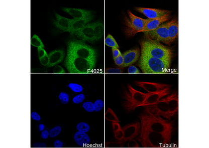 Glucose 6 Phosphate Dehydrogenase Antibody