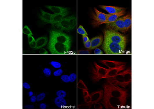 Glucose 6 Phosphate Dehydrogenase Antibody