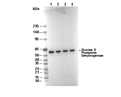 Glucose 6 Phosphate Dehydrogenase Antibody