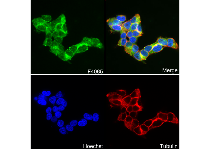 TIMP3 Antibody
