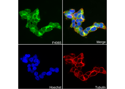 TIMP3 Antibody