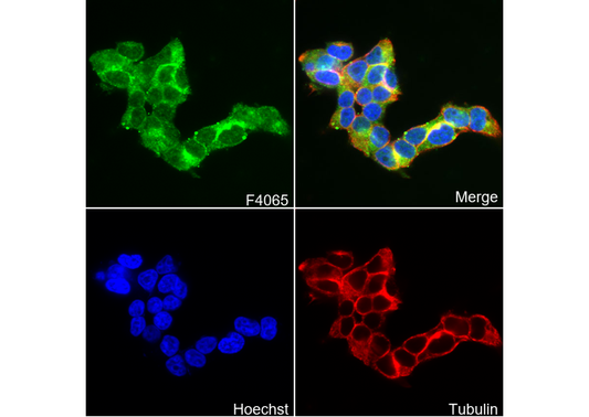 TIMP3 Antibody