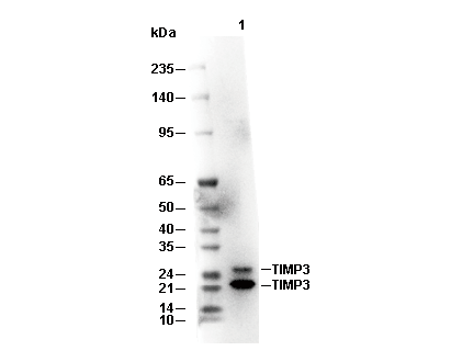 TIMP3 Antibody