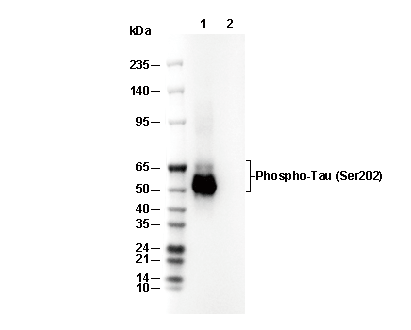 Phospho-Tau (Ser202) Antibody