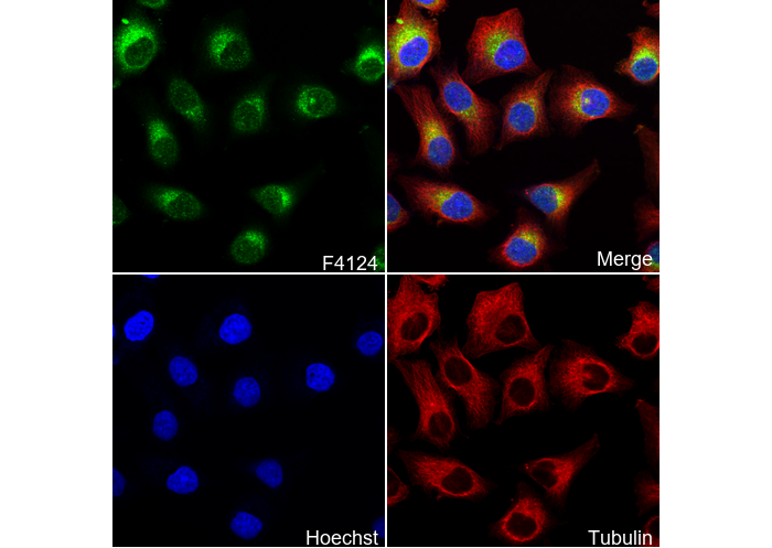 Phospho-GSK-3β (Ser9) Antibody