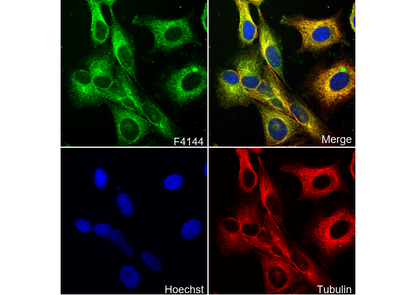 Insulin Receptor β Antibody