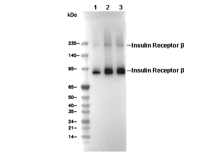 Insulin Receptor β Antibody