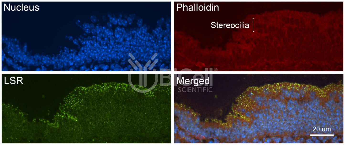 LSR (Angulin-1) Antibody - Western Blot Validated
