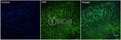 Amyloid-beta Precursor Protein (APP or AD1) Antibody - Western Blot Validated