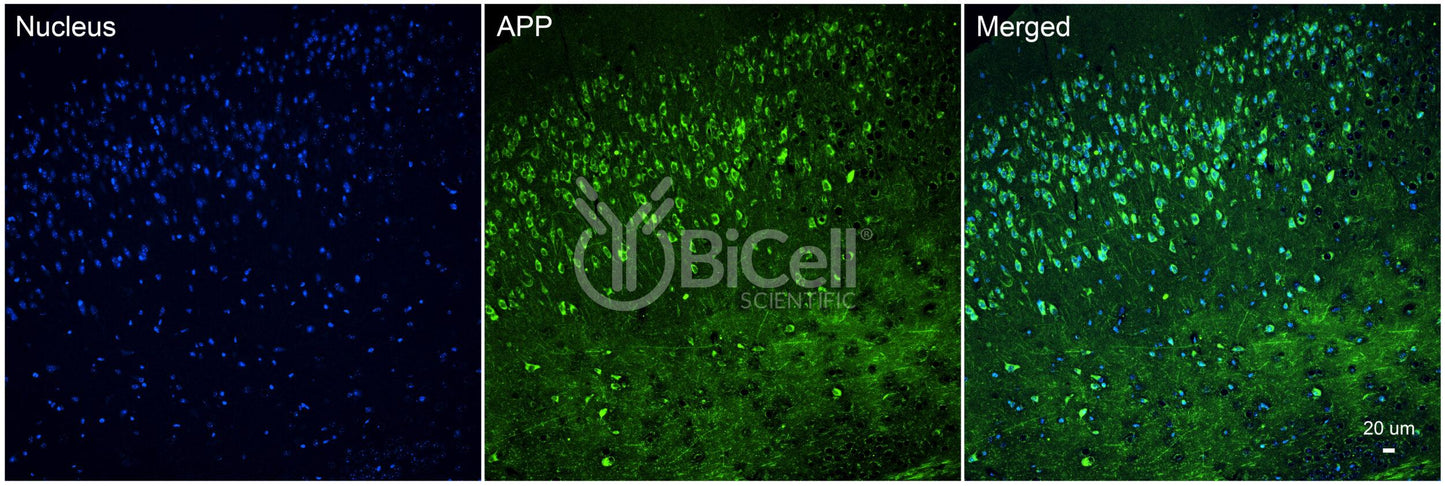 Amyloid-beta Precursor Protein (APP or AD1) Antibody