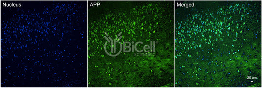 Amyloid-beta Precursor Protein (APP or AD1) Antibody - FFPE Validated