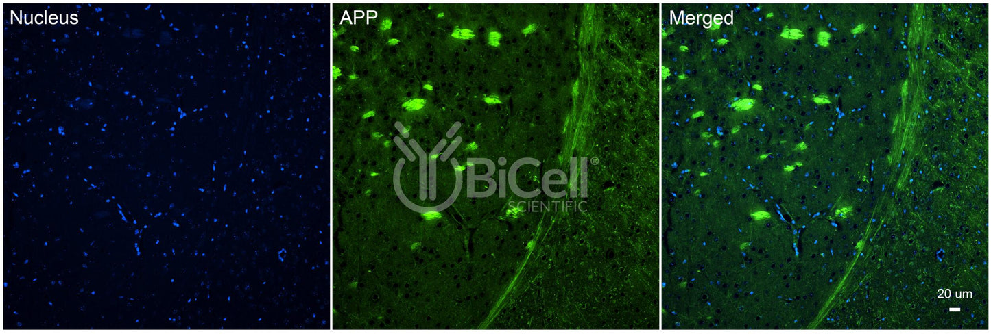 Amyloid-beta Precursor Protein (APP or AD1) Antibody