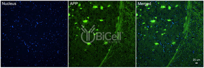 Amyloid-beta Precursor Protein (APP or AD1) Antibody