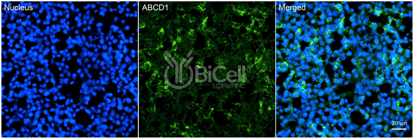 ABCD1 Antibody - Western Blot Validated