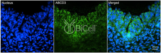 ABCD3 Antibody - FFPE Validated