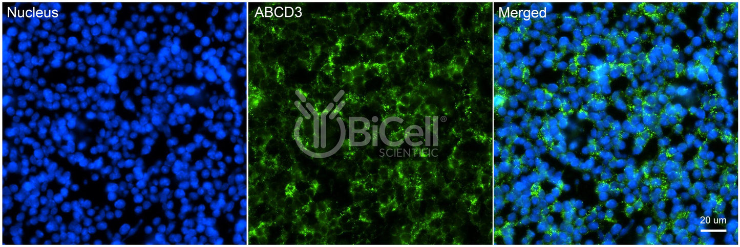 ABCD3 Antibody
