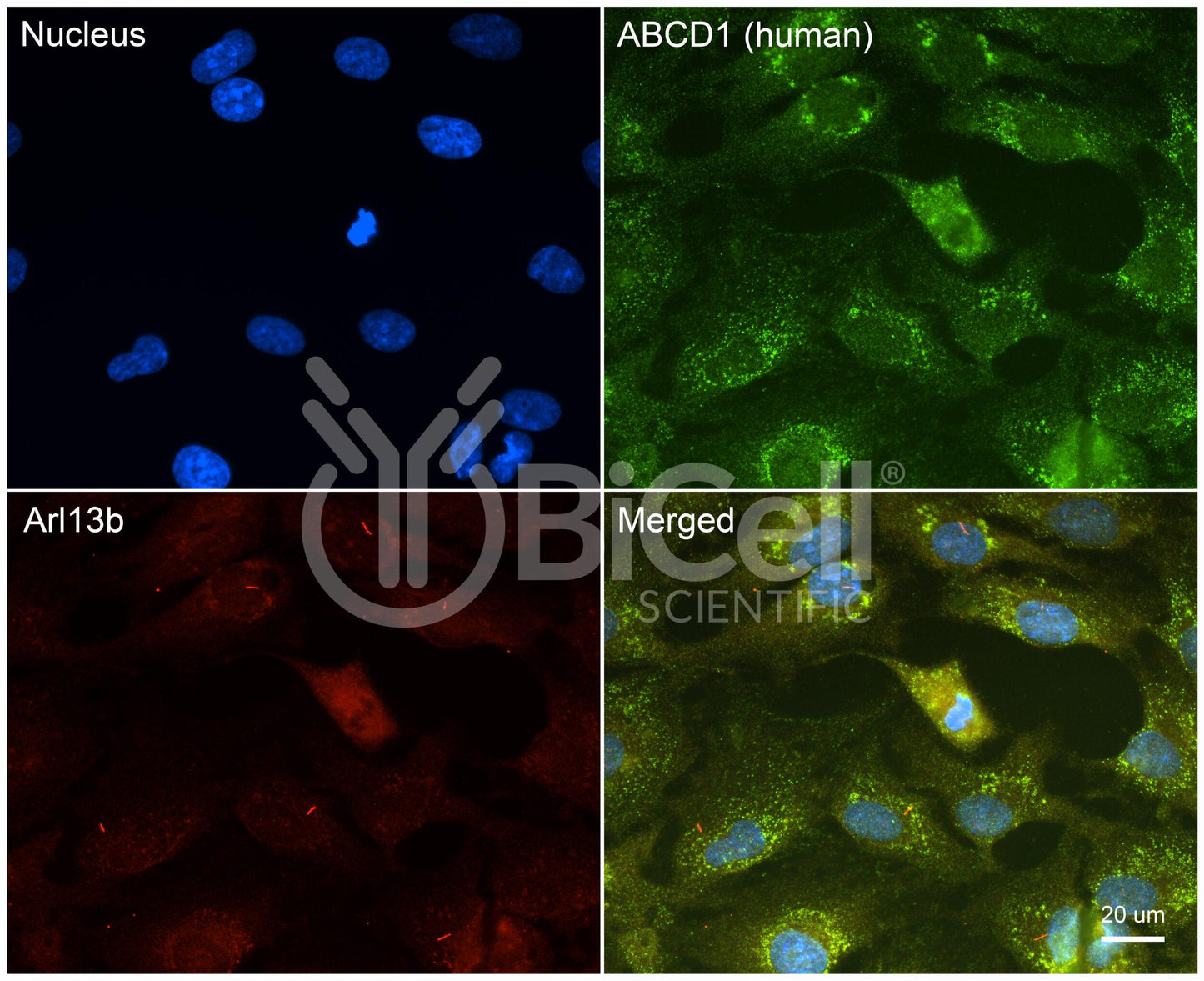 ABCD1 (Human) HiRe Antibody