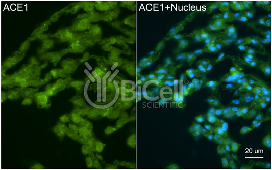 ACE1 (ACE or CD143) Antibody - Western Blot Validated