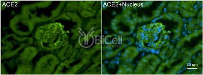 ACE2 Antibody