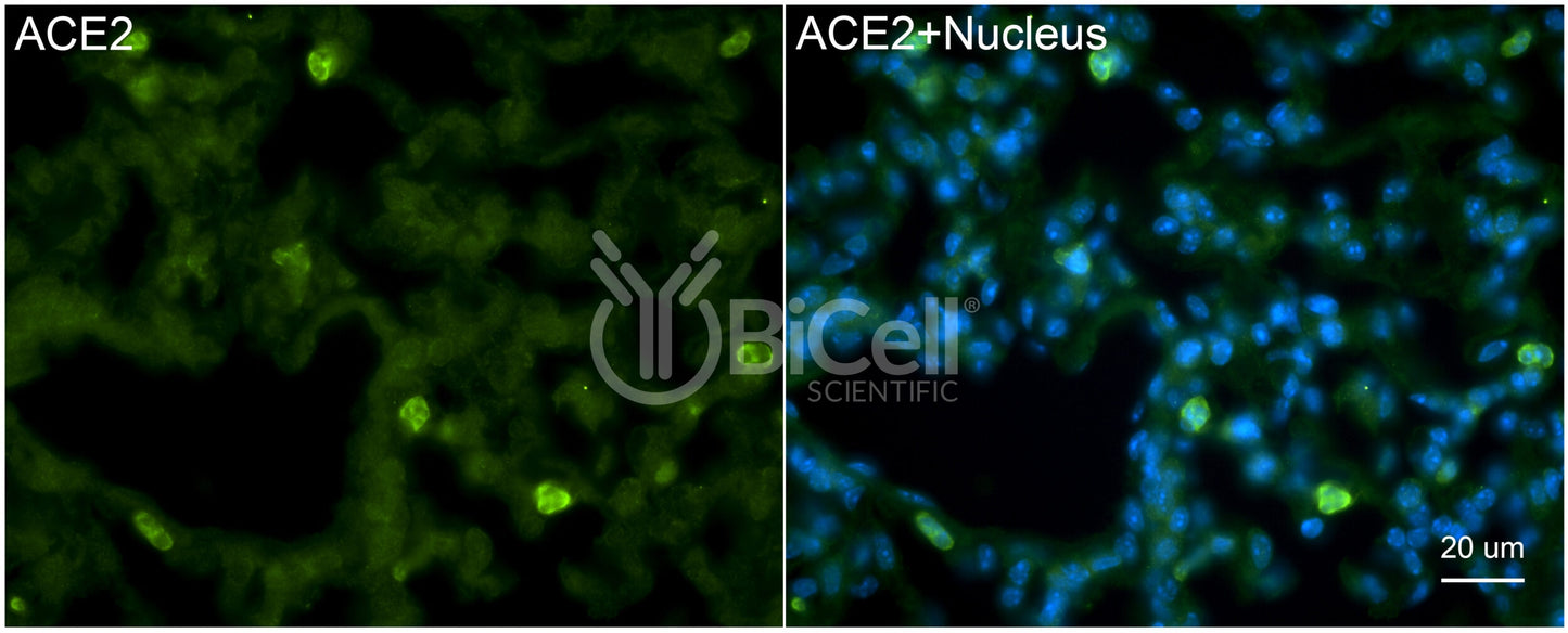 ACE2 Antibody - Western Blot Validated