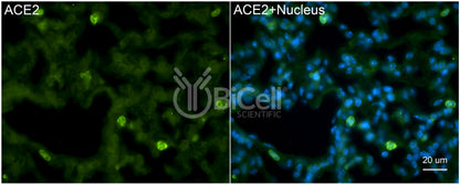 ACE2 Antibody