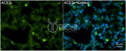 ACE2 Antibody