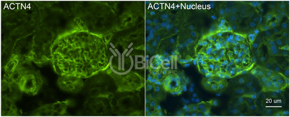 Actinin alpha-4 (ACTN4) Antibody - FFPE Validated