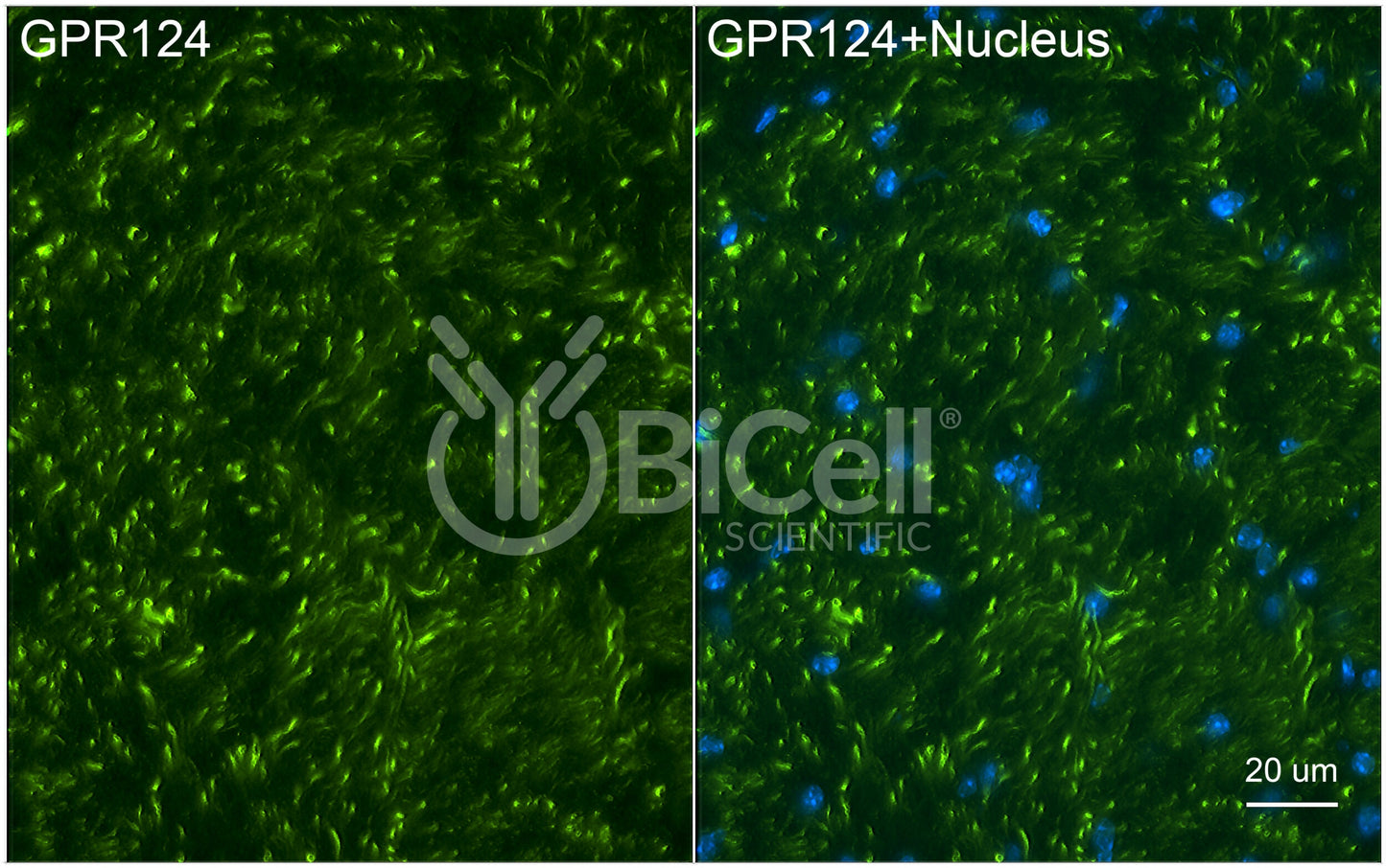 ADGRA2 (GPR124) Antibody