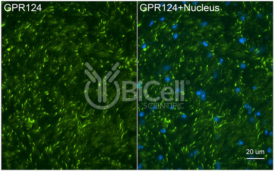 ADGRA2 (GPR124) Antibody