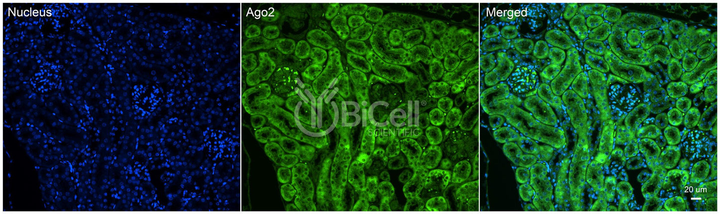 AGO2 Antibody - Western Blot Validated