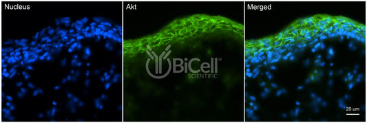AKT (AKT1 or RAC or PKB) Antibody