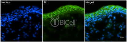 AKT (AKT1 or RAC or PKB) Antibody - FFPE Validated