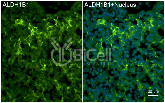 ALDH1B1 (ALDH5 or ALDHX) Antibody - FFPE Validated