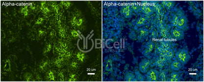 Alpha-catenin (Ctnna1) Antibody - Western Blot Validated