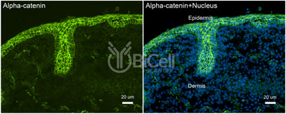 Alpha-catenin (Ctnna1) Antibody