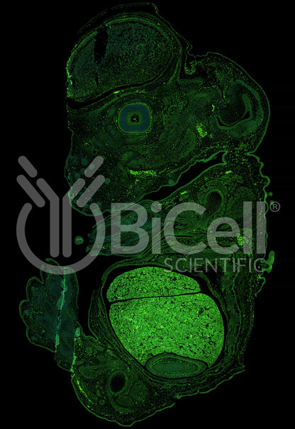 Anillin (ANLN or FSGS8) Antibody