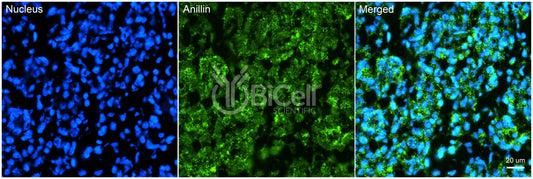 Anillin (ANLN or FSGS8) Antibody