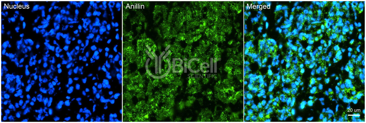 Anillin (ANLN or FSGS8) Antibody - Western Blot Validated