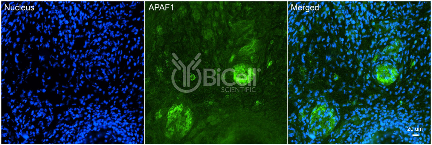 APAF1 (CED4) Antibody