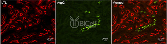 Aquaporin-2 (AQP2) Antibody - FFPE Validated