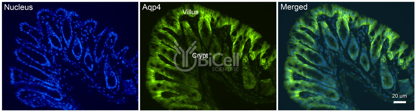 Aquaporin-4 (AQP4) Antibody