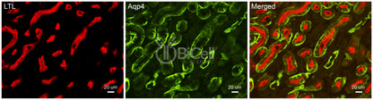 Aquaporin-4 (AQP4) Antibody