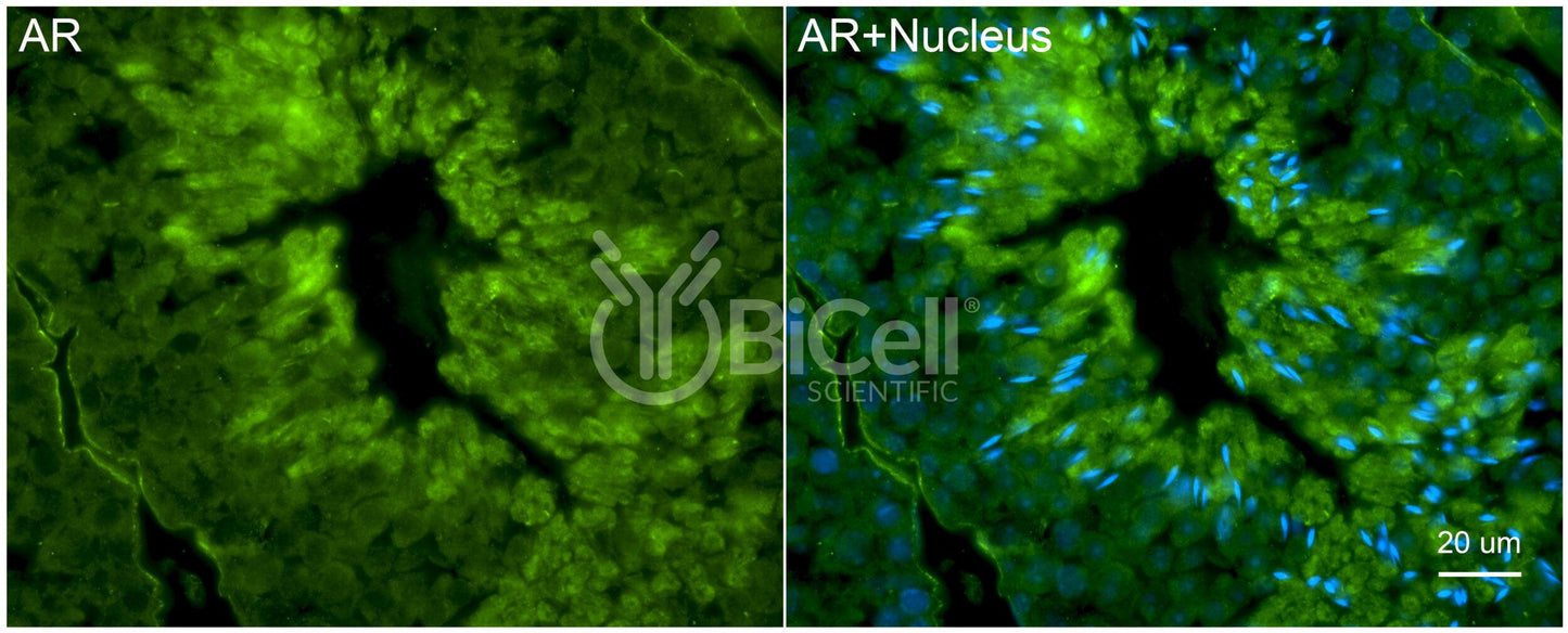 AR (NR3C4) Antibody - FFPE Validated