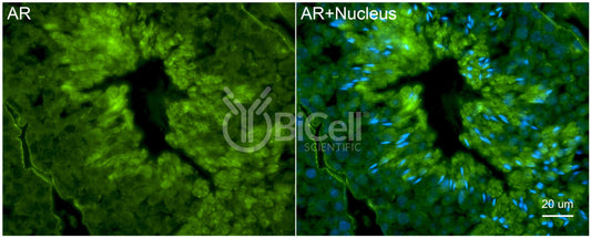 AR (NR3C4) Antibody - FFPE Validated