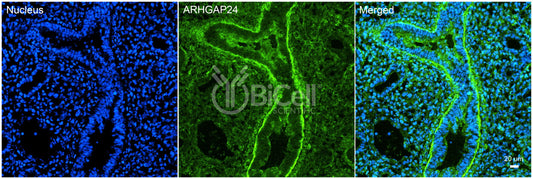 ARHGAP24 (FILGAP or p73) Antibody - Western Blot Validated