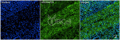ARHGAP24 (FILGAP or p73) Antibody - Western Blot Validated