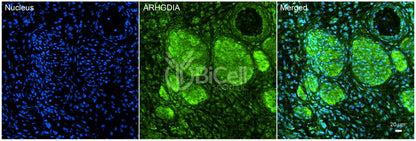 ARHGDIA (GDIA1 or NPHS8) Antibody