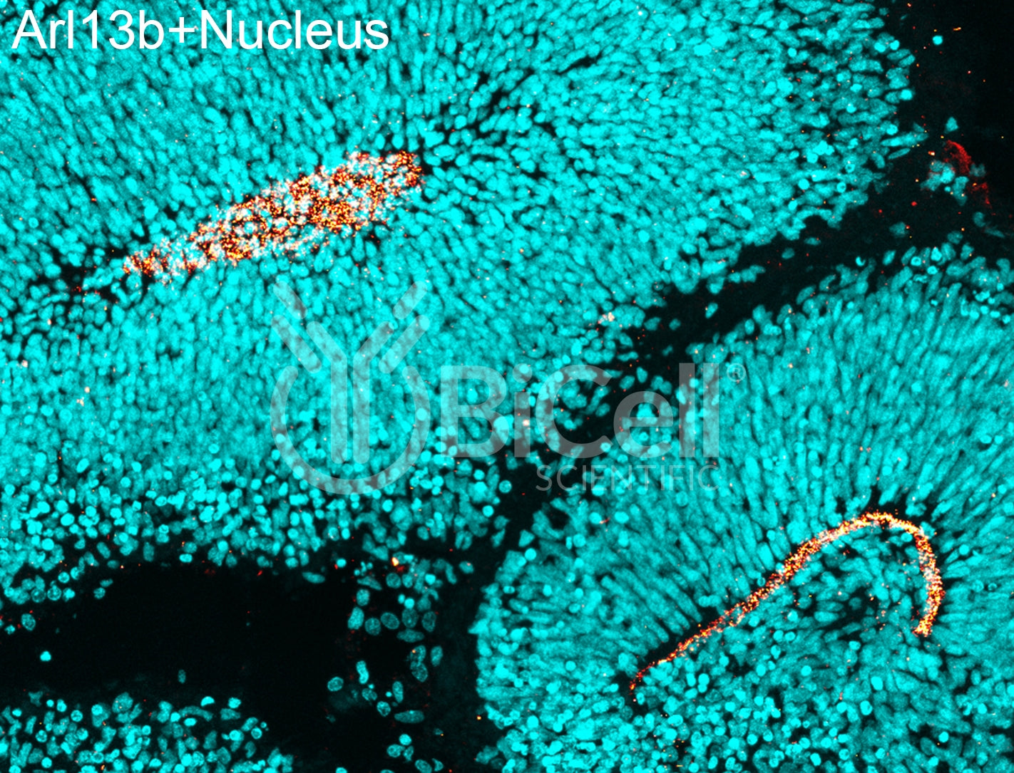 ARL13B (ARL2L1) HiRe Antibody - Western Blot Validated